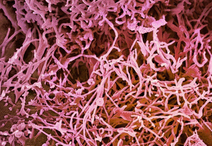 Image: Colored scanning electron micrograph (SEM) of the surface of a cervical cancer cell, showing microvilli strands that are small projections of the cell’s cytoplasm (Photo courtesy of Steve Gschmeissner / SPL).